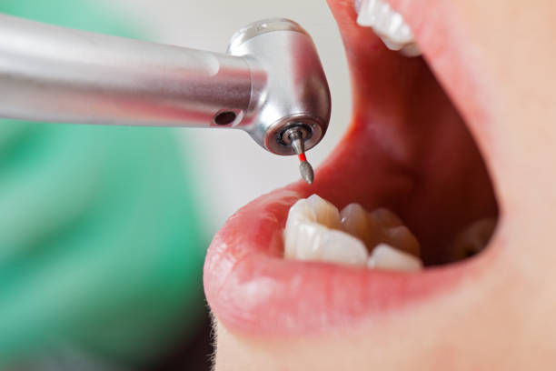 Best Weekend Emergency Dentist in Sabina, OH